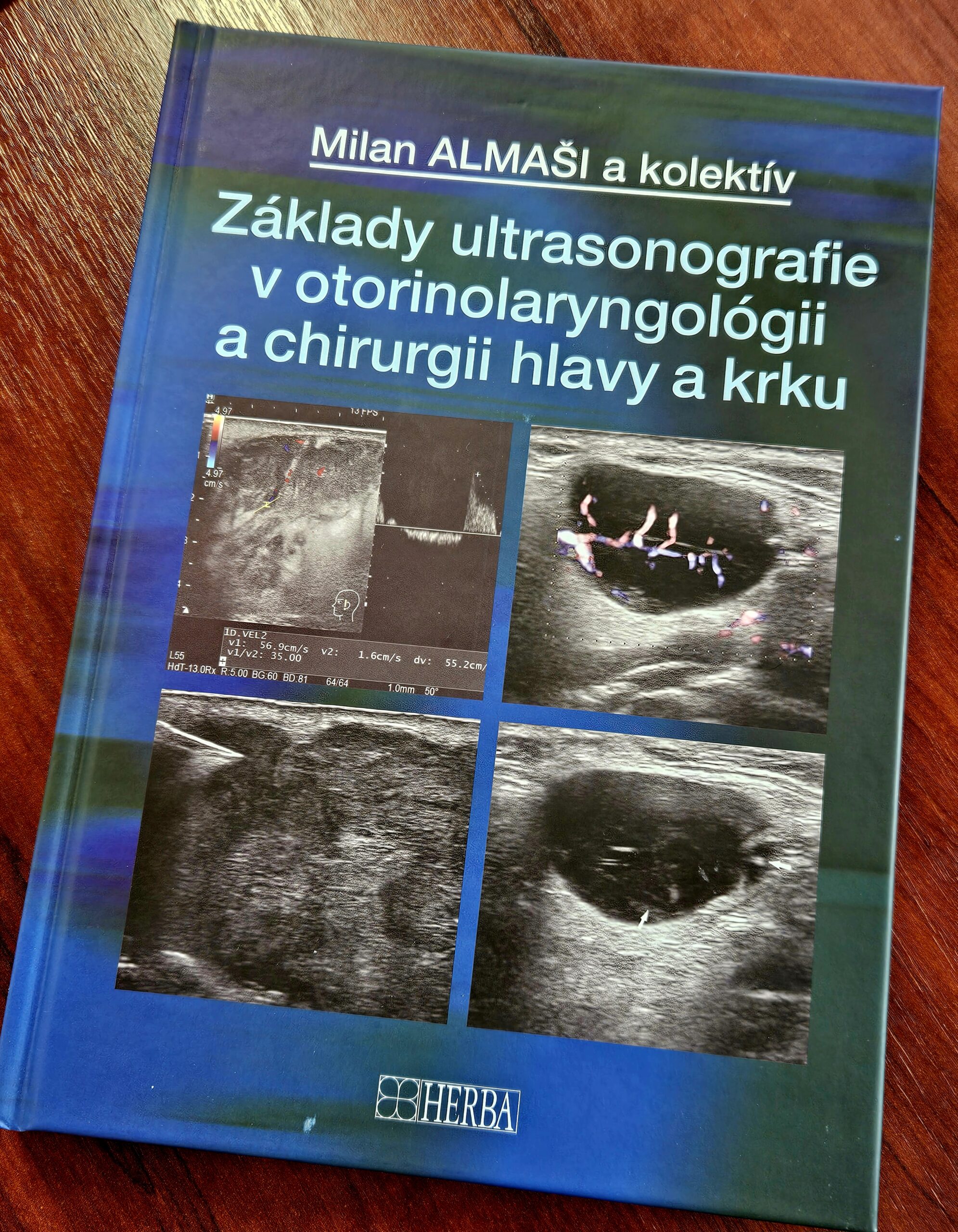 Ultrasonografia v ORL a chirurgii hlavy a krku